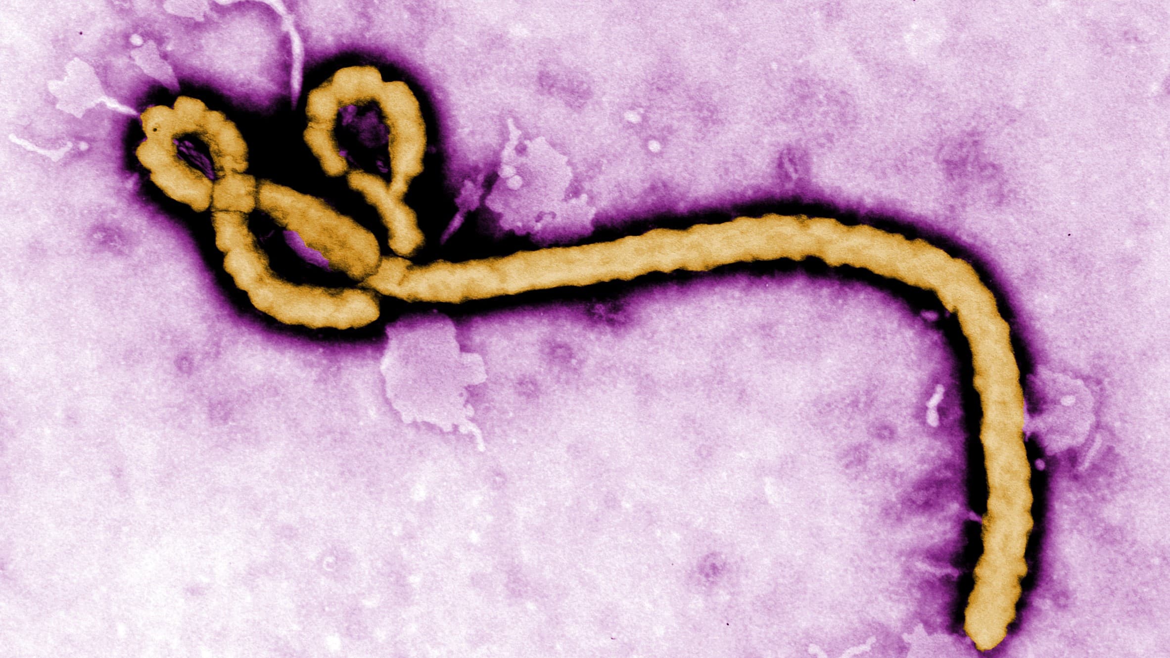 Ebola Preparedness in Nigeria 2026: What You Need to Know
